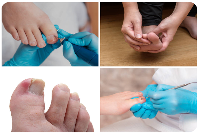 Limpieza Facial Completa